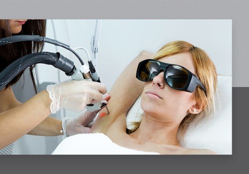 Can You Wear Sunglasses for Laser Hair Removal? - An Expert's Perspective